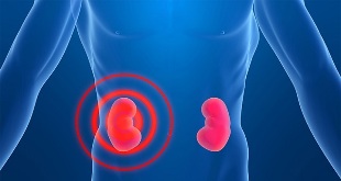 The signs of pain in the kidneys