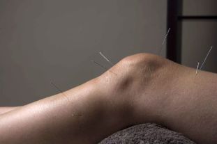 Acupuncture promotes the repair of joint tissues